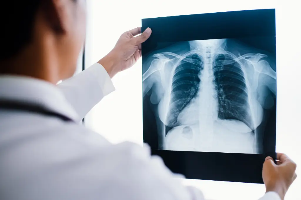 Urgent X-Ray Service Clear Lake Houston, Texas