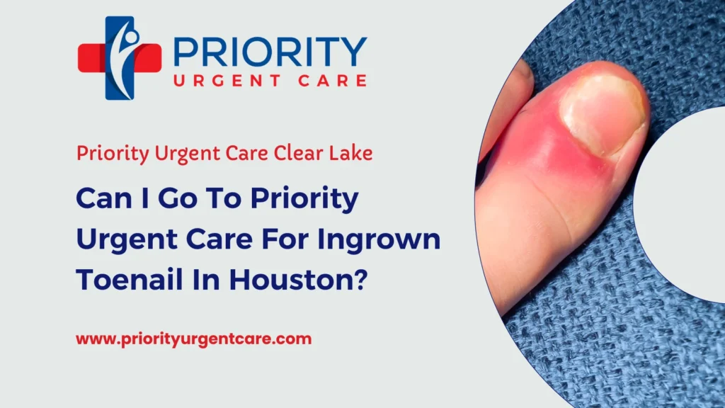 Can I Go To Priority Urgent Care For Ingrown Toenail In Houston