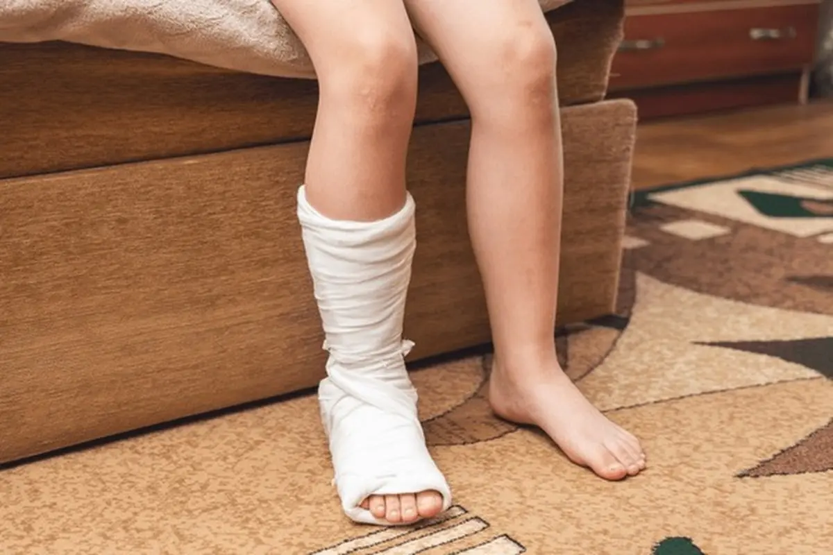 understanding bone fractures at priority urgent care, clear lake, TX