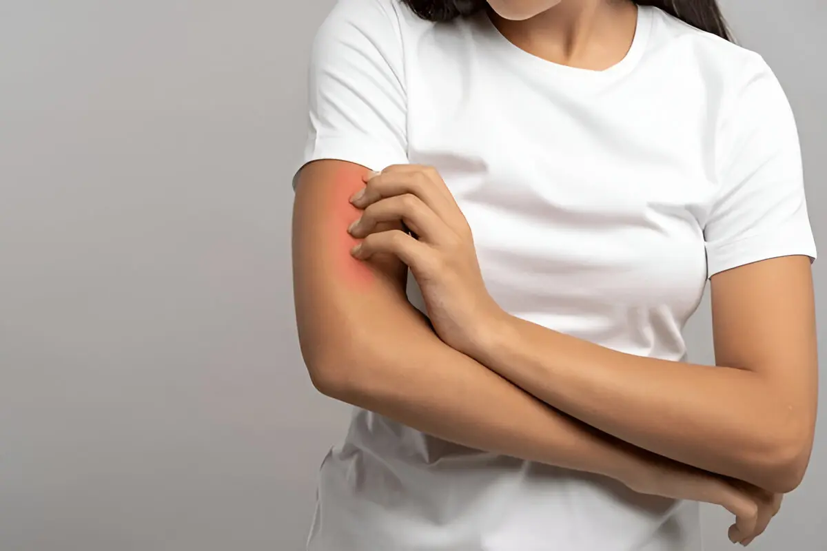 fungal infection: what o expect during visit at priority urgent care