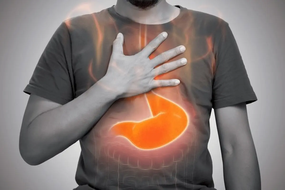 Acid Reflux: What to expect during your urgent care visit
